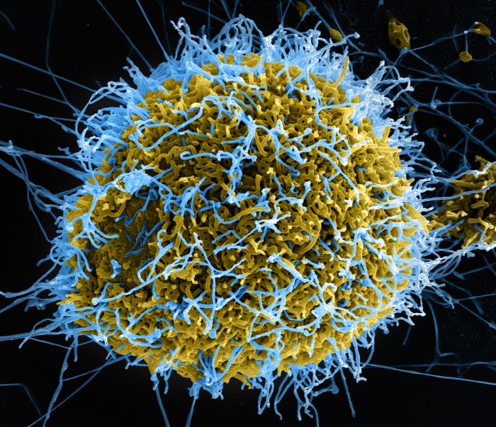 Digitálně dobarvená fotografie z rastrovacího elektronového mikroskopu ukazuje masivní množení viru Ebola (modře). Na fotografii je zachycen okamžik, kdy virus opouští infikovanou buňku (VERO E6, žlutě) nakažené africké opice. Credit: National Institute of Allergy and Infectious Diseases (NIAID)